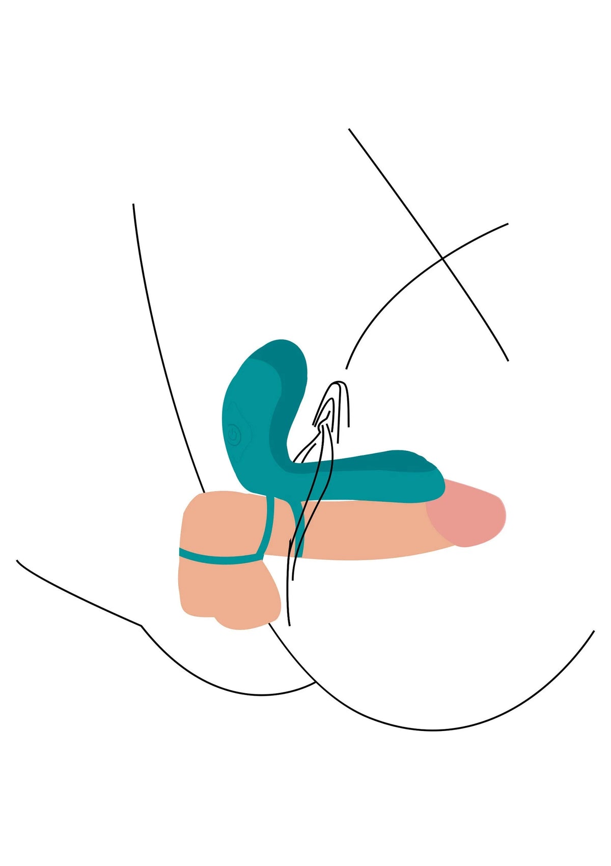 Turquoise vibratorring in gebruik: schematische plaatsing met lijnen