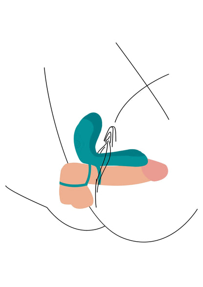 Turquoise vibratorring in gebruik: schematische plaatsing met lijnen